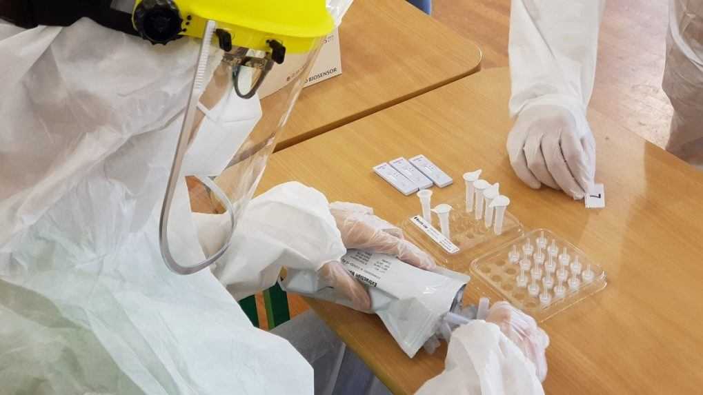 Nemecko nebude od októbra ponúkať bezplatné testy na koronavírus