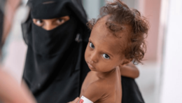 Dieťa v Jemene.