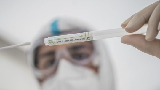 Na snímke zdravotný pracovník vkladá tyčinku do tuby po odobratí vzorky na PCR test na ochorenie Covid-19.