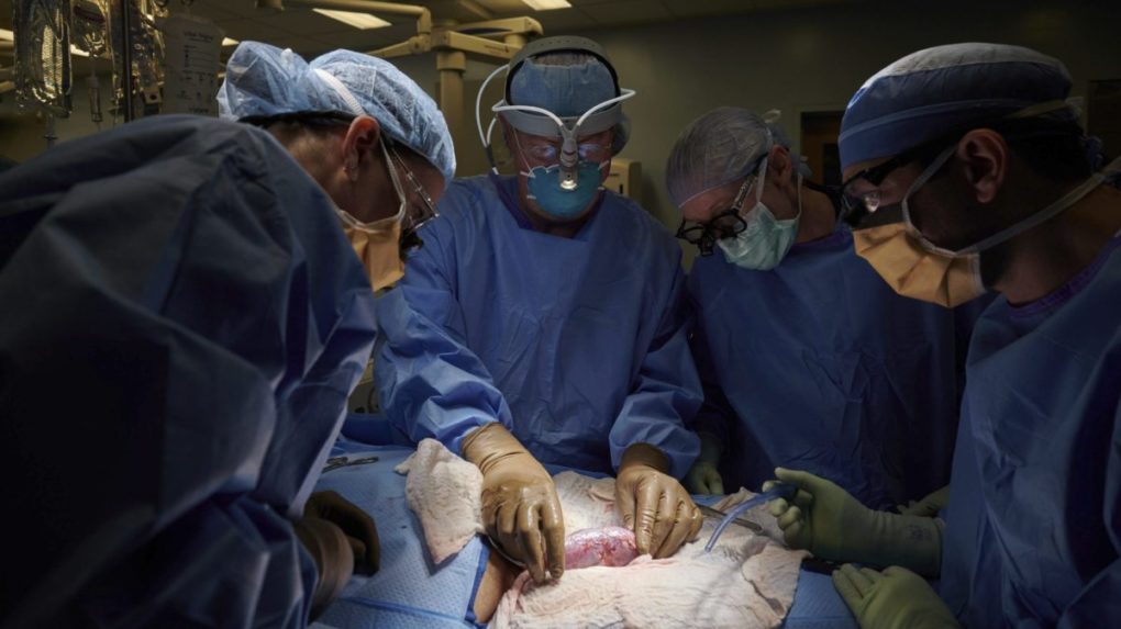 Historická transplantácia srdca dáva nádej státisícom chorých ľudí