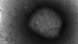 Snímka z elektronického mikroskopu zobrazuje vírus opičích kiahní.