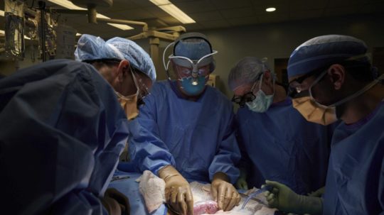 Snímok lekárov vykonávajúcich transplantáciu obličky