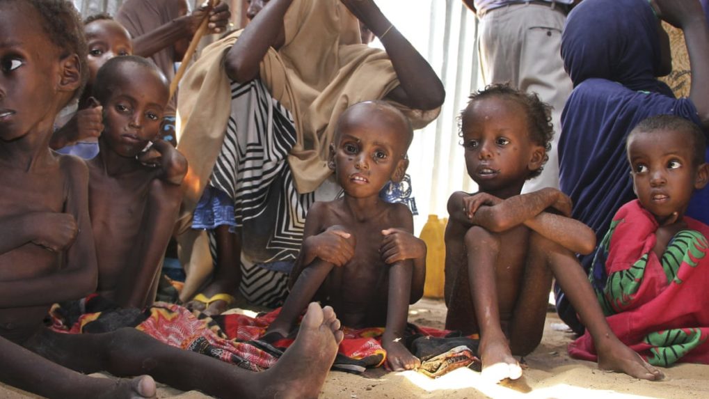 Smrť v dôsledku podvýživy ohrozuje osem miliónov detí, varoval UNICEF