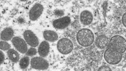 Na snímke z elektrónového mikroskopu sú zobrazené zrelé vírusové častice opičích kiahní.