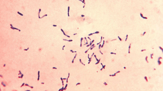 Na snímke z mikroskopu baktéria Corynebacterium diphtheriae spôsobujúca záškrt.