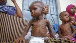 Povýživené deti v Somálsku.