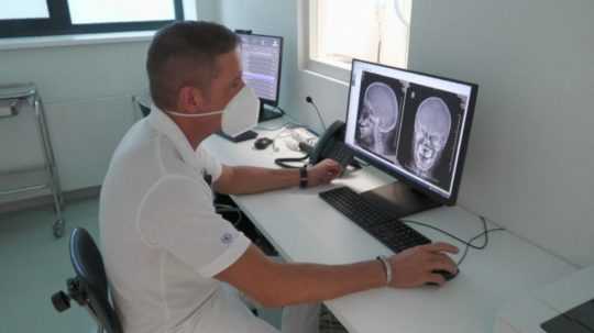 Na snímke lekár študuje rontgenovú snímku pacienta.