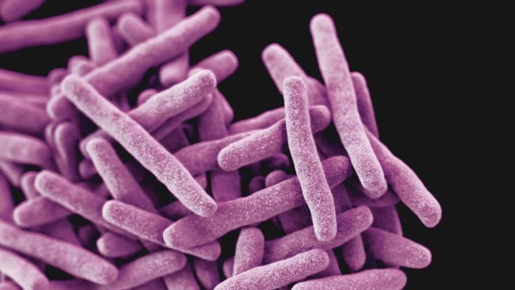 Tuberkulóza sa opäť šíri s novou silou, varuje WHO