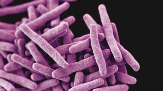 Baktéria Mycobacterium tuberculosis, patogén spôsobujúci ochorenie tuberkulóza.