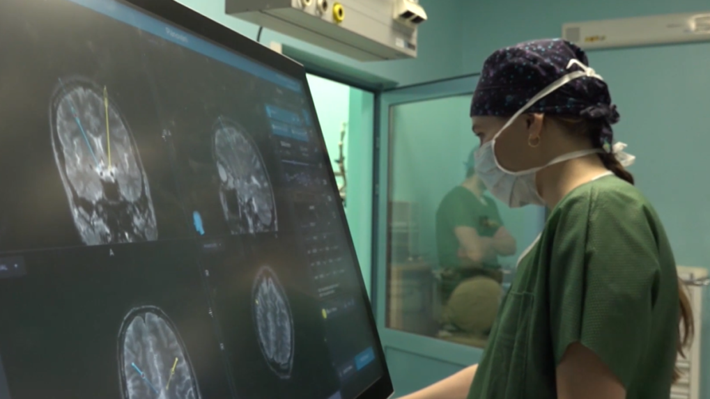 Podstúpil operáciu mozgu, ktorá sa na Slovensku robila prvýkrát