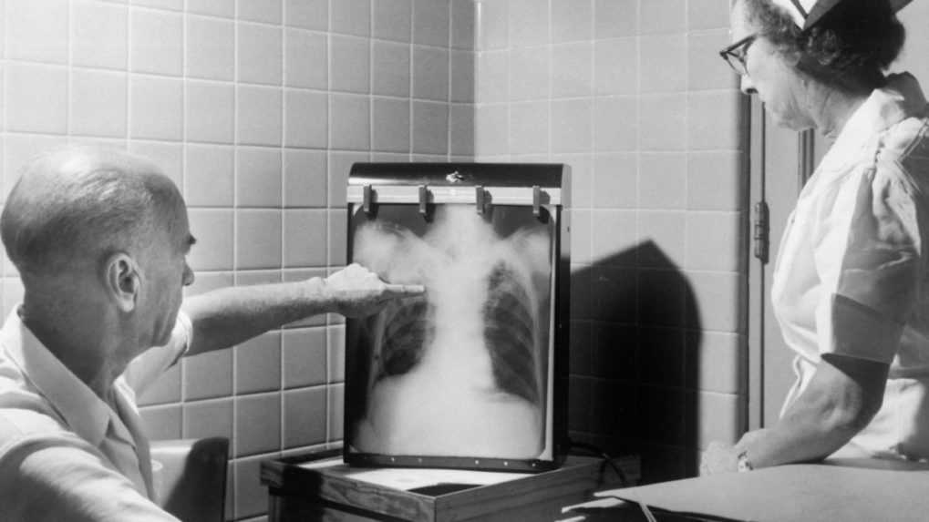 Ilustračná snímka skúmania röntgenovej snímky lekárom.