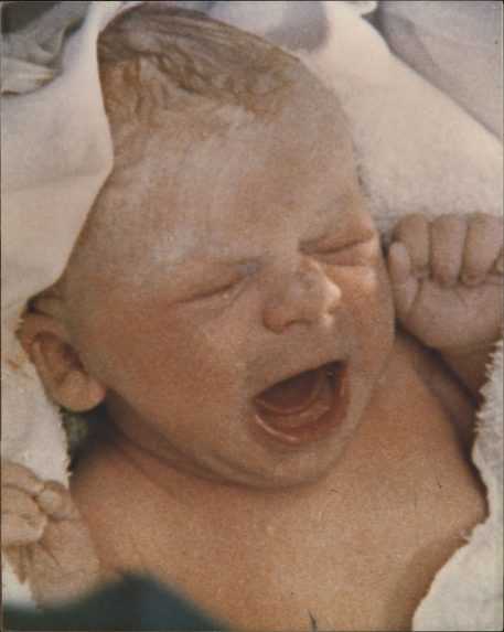 Prvé dieťa zo skúmavky: Louise Joy Brown tesne po narodení v nemocnici Oldham 25. júla 1978.