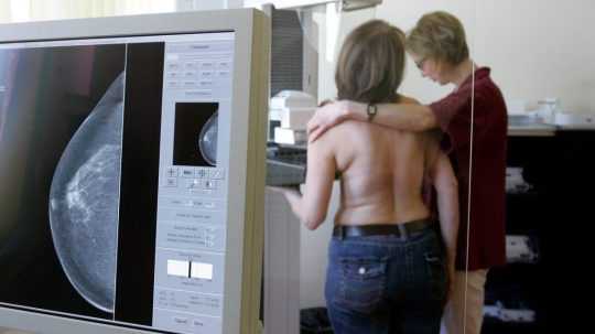 Na ilustračnej snímke pacientka na mamografickom vyšetrení.