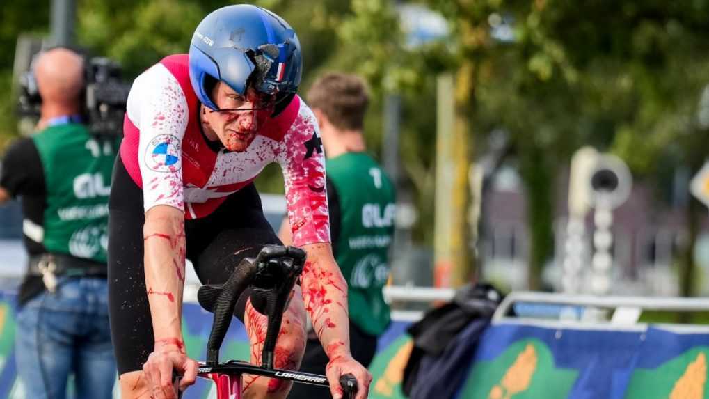 Švajčiarsky cyklista Küng utrpel pri páde niekoľko zlomenín a otras mozgu. Aj napriek tomu prišiel do cieľa