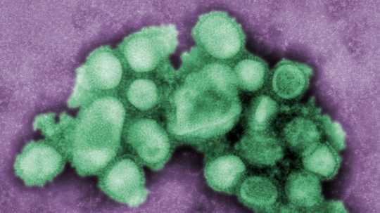 Na snímke vírus prasacej chrípky.