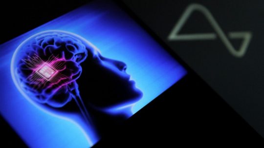 Prvý pacient, ktorému spoločnosť Neuralink implantovala mozgový čip, teraz dokáže svojimi myšlienkami hýbať kurzorom myši na obrazovke.