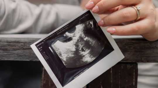 Ilustračná snímka ultrazvuku tehotnej ženy.