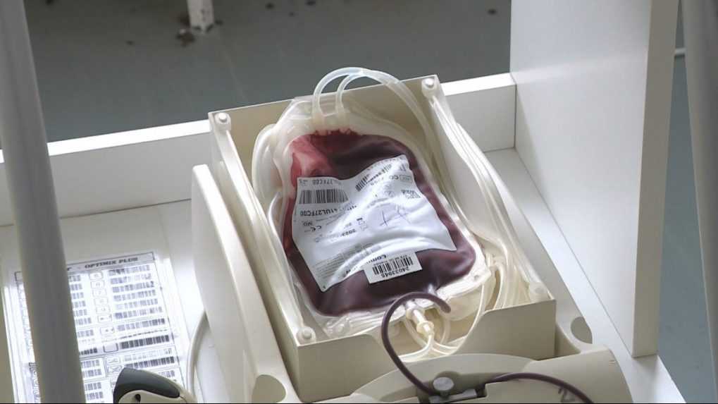 Slovensko má nedostatok krvi: Hrozí, že sa obmedzia objednávky krvi nemocniciam