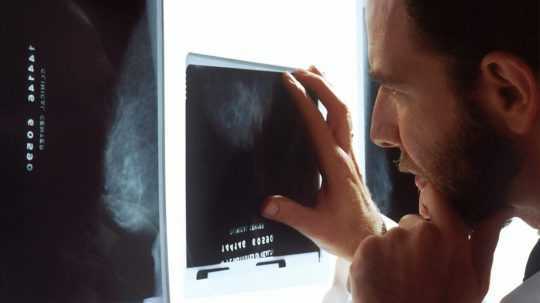 Lekár skúma röntgen prsníka.