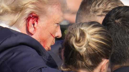 Guľka Donaldolvi Trumpovi poranila hornú časť pravého ucha a mal silné krvácanie.