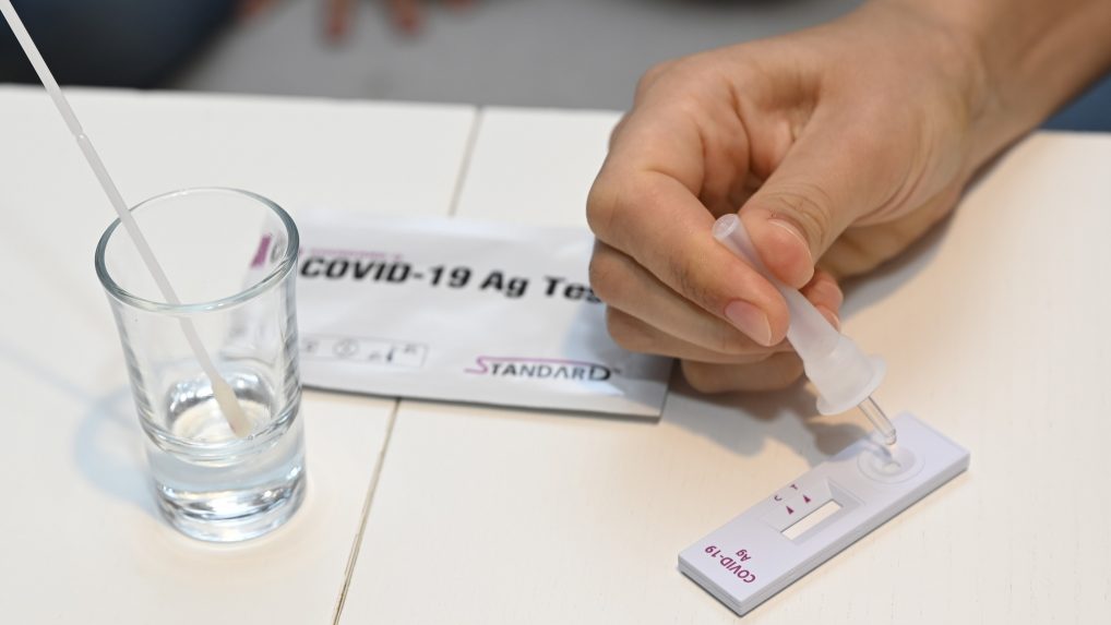 COVID-19 a chrípku odlíši len test, príznaky sú takmer rovnaké, upozornil infektológ