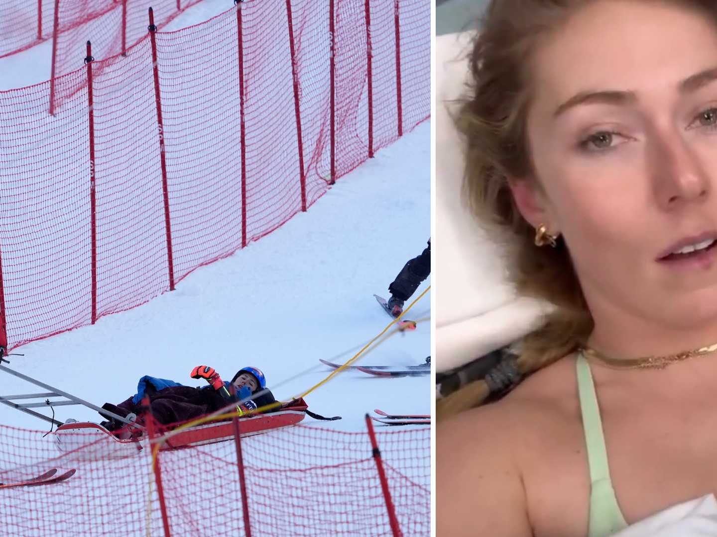 Shiffrinová utrpela po páde bodnú ranu a poranenie svalov. Jej návrat na svahy je zatiaľ otázny